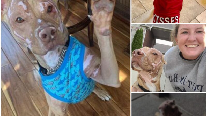 The severely burned pitbull overcame every challenge, and now he loves life more than ever.